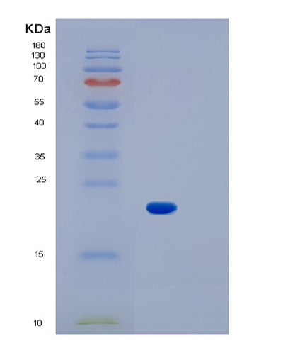 SDS-PAGE analysis of Mouse Il1b (Interleukin-1 Beta) - Recombinant Protein, CAT# BLT-01531P, showing >85% purity under 15% SDS-PAGE (Reduced)Mouse Il1b (Interleukin-1 Beta) - Recombinant Protein