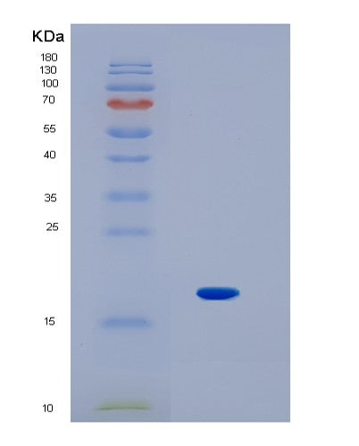 SDS-PAGE analysis of Human IL1F10 (Interleukin-1 Family Member 10) - Recombinant Protein, CATHuman IL1F10 (Interleukin-1 Family Member 10) - Recombinant Protein