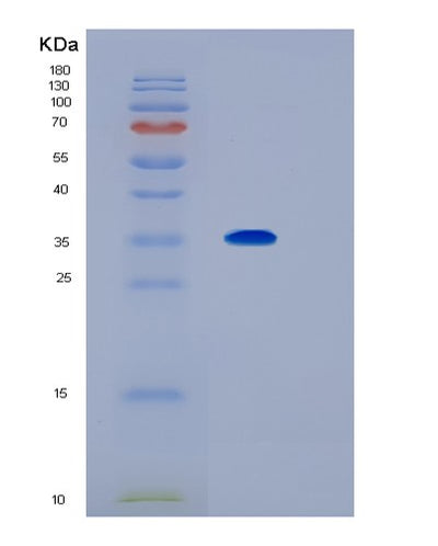 SDS-PAGE analysis of Human IL1RL1 (Interleukin-1 Receptor-Like 1) - Recombinant Protein, CAT# BLT-01534P, showing >85% purity under 15% SDS-PAGE (Reduced)Human IL1RL1 (Interleukin-1 Receptor-Like 1) - Recombinant Protein