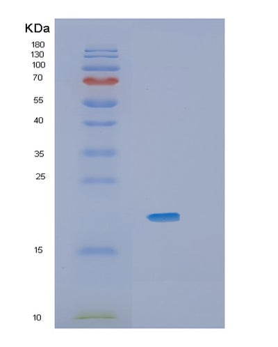 SDS-PAGE analysis of Mouse Il36a (Interleukin-36 Alpha) - Recombinant Protein, CAT# BLT-01544P, showing >90% purity under 15% SDS-PAGE (Reduced)Mouse Il36a (Interleukin-36 Alpha) - Recombinant Protein
