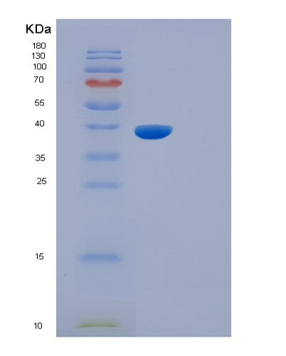 SDS-PAGE analysis of Mouse Il5ra (Interleukin-5 Receptor Subunit Alpha) - Recombinant Protein, CATMouse Il5ra (Interleukin-5 Receptor Subunit Alpha) - Recombinant Protein