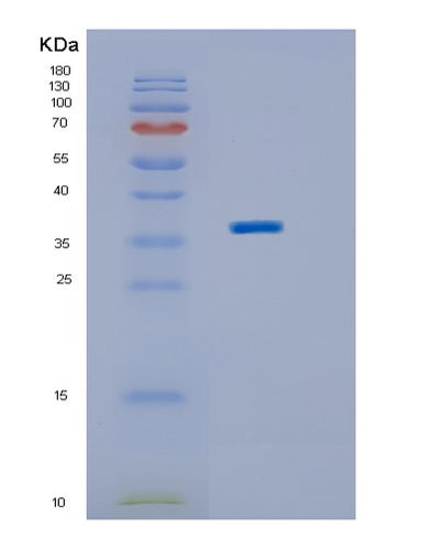 SDS-PAGE analysis of Human BPNT2 (Golgi-Resident Adenosine 3',5'-Bisphosphate 3'-Phosphatase) - Recombinant Protein, CAT# BLT-01561P, showing >90% purity under 15% SDS-PAGE (Reduced)Human BPNT2 (Golgi-Resident Adenosine 3',5'-Bisphosphate 3'-Phosphatase) - Recombinant Protein