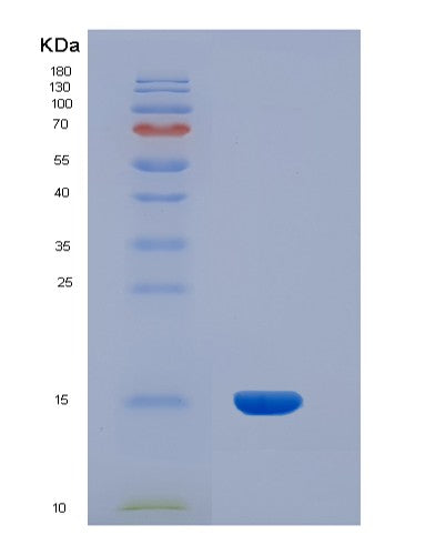 SDS-PAGE analysis of Human INHBA (Inhibin Beta A Chain) - Recombinant Protein, CATHuman INHBA (Inhibin Beta A Chain) - Recombinant Protein