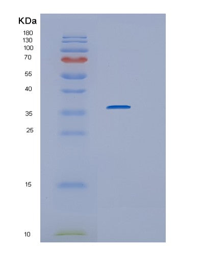 SDS-PAGE analysis of Human IL1R1 (Interleukin-1 Receptor Type 1) - Recombinant Protein, CATHuman IL1R1 (Interleukin-1 Receptor Type 1) - Recombinant Protein