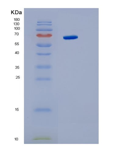 SDS-PAGE analysis of Human IL6ST (Interleukin-6 Receptor Subunit Beta) - Recombinant Protein, CAT# BLT-01581P, showing >95% purity under 15% SDS-PAGE (Reduced)Human IL6ST (Interleukin-6 Receptor Subunit Beta) - Recombinant Protein