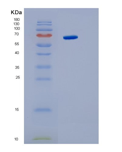 SDS-PAGE analysis of Human IL6ST (Interleukin-6 Receptor Subunit Beta) - Recombinant Protein, CATHuman IL6ST (Interleukin-6 Receptor Subunit Beta) - Recombinant Protein