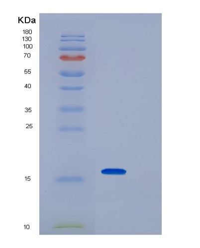 SDS-PAGE analysis of Human IPP (Actin-Binding Protein Ipp) - Recombinant Protein, CATHuman IPP (Actin-Binding Protein Ipp) - Recombinant Protein