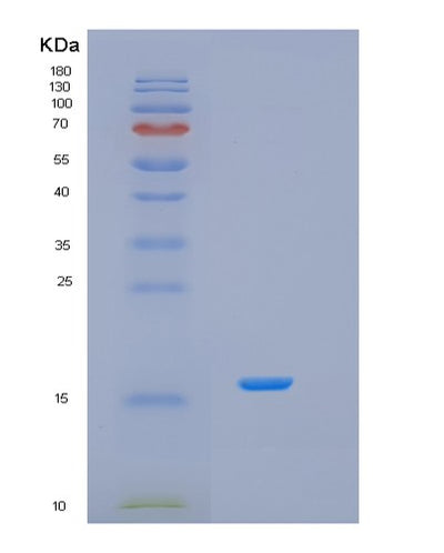 SDS-PAGE analysis of Human ISOC2 (Isochorismatase Domain-Containing Protein 2) - Recombinant Protein, CAT# BLT-01590P, showing >90% purity under 15% SDS-PAGE (Reduced)Human ISOC2 (Isochorismatase Domain-Containing Protein 2) - Recombinant Protein
