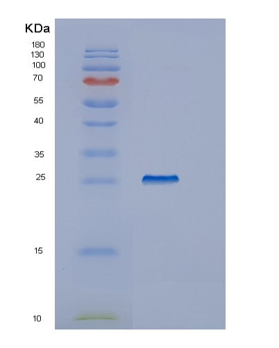 SDS-PAGE analysis of Human IYD (Iodotyrosine Deiodinase 1) - Recombinant Protein, CATHuman IYD (Iodotyrosine Deiodinase 1) - Recombinant Protein