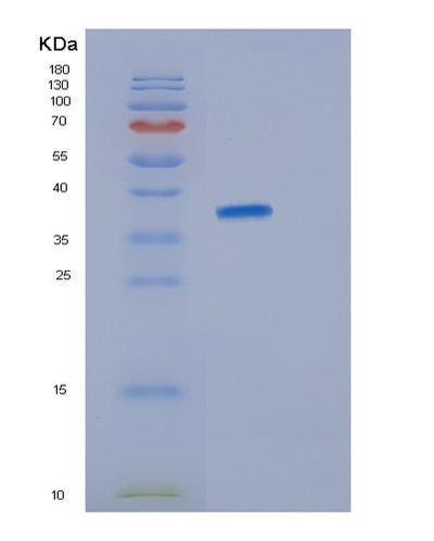 SDS-PAGE analysis of Human JSRP1 (Junctional Sarcoplasmic Reticulum Protein 1) - Recombinant Protein, CAT# BLT-01609P, showing >85% purity under 15% SDS-PAGE (Reduced)Human JSRP1 (Junctional Sarcoplasmic Reticulum Protein 1) - Recombinant Protein