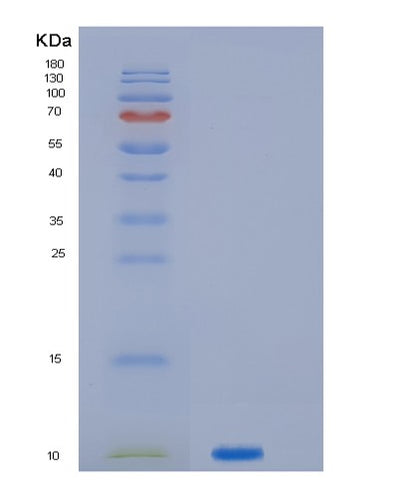 SDS-PAGE analysis of Human JTB (Protein Jtb) - Recombinant Protein, CAT# BLT-01610P, showing >95% purity under 15% SDS-PAGE (Reduced)Human JTB (Protein Jtb) - Recombinant Protein