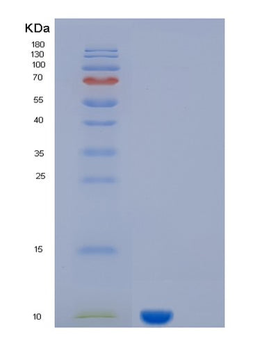 SDS-PAGE analysis of Human KAAG1 (Kidney-Associated Antigen 1) - Recombinant Protein, CAT# BLT-01611P, showing >90% purity under 15% SDS-PAGE (Reduced)Human KAAG1 (Kidney-Associated Antigen 1) - Recombinant Protein