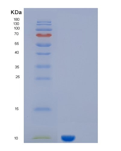 SDS-PAGE analysis of Human KAAG1 (Kidney-Associated Antigen 1) - Recombinant Protein, CATHuman KAAG1 (Kidney-Associated Antigen 1) - Recombinant Protein