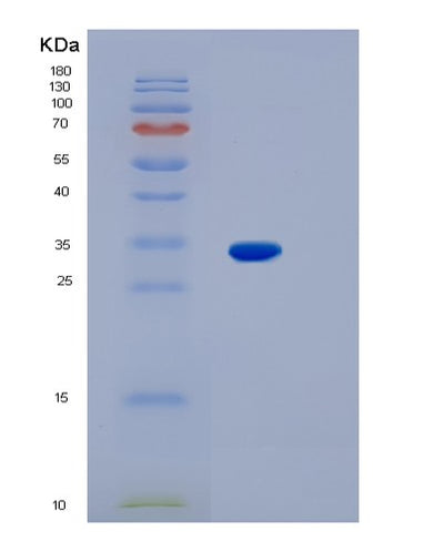 SDS-PAGE analysis of Human KCNIP3 (Calsenilin) - Recombinant Protein, CAT# BLT-01613P, showing >95% purity under 15% SDS-PAGE (Reduced)Human KCNIP3 (Calsenilin) - Recombinant Protein