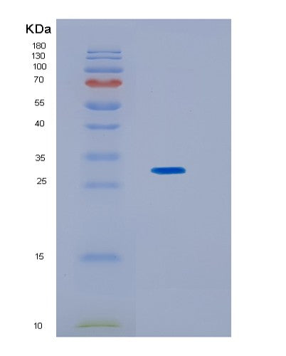 SDS-PAGE analysis of Human KCTD5 (Btb/Poz Domain-Containing Protein Kctd5) - Recombinant Protein, CATHuman KCTD5 (Btb/Poz Domain-Containing Protein Kctd5) - Recombinant Protein