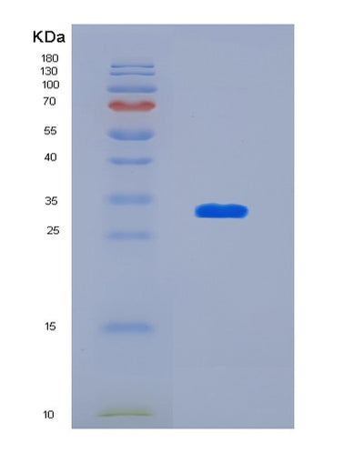 SDS-PAGE analysis of Human KHK (Ketohexokinase) - Recombinant Protein, CAT# BLT-01621P, showing >85% purity under 15% SDS-PAGE (Reduced)Human KHK (Ketohexokinase) - Recombinant Protein