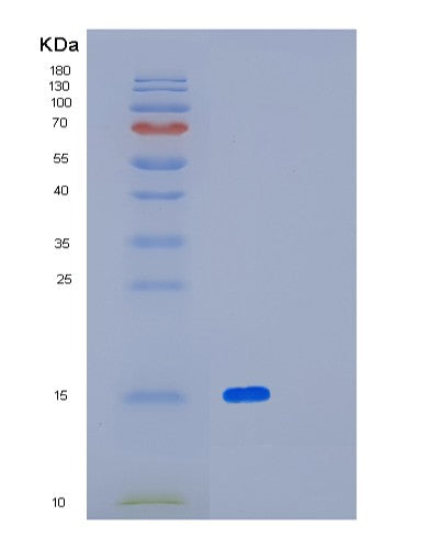 SDS-PAGE analysis of Human CD47 (Leukocyte Surface Antigen Cd47) - Recombinant Protein, CATHuman CD47 (Leukocyte Surface Antigen Cd47) - Recombinant Protein