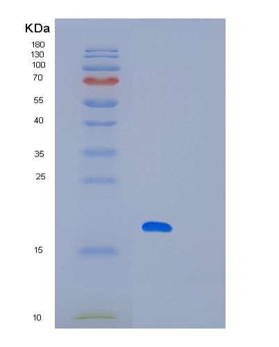 SDS-PAGE analysis of Human LITAF (Lipopolysaccharide-Induced Tumor Necrosis Factor-Alpha Factor) - Recombinant Protein, CATHuman LITAF (Lipopolysaccharide-Induced Tumor Necrosis Factor-Alpha Factor) - Recombinant Protein