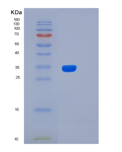 SDS-PAGE analysis of Human BIRC7 (Baculoviral Iap Repeat-Containing Protein 7) - Recombinant Protein, CAT# BLT-01730P, showing >90% purity under 15% SDS-PAGE (Reduced)Human BIRC7 (Baculoviral Iap Repeat-Containing Protein 7) - Recombinant Protein