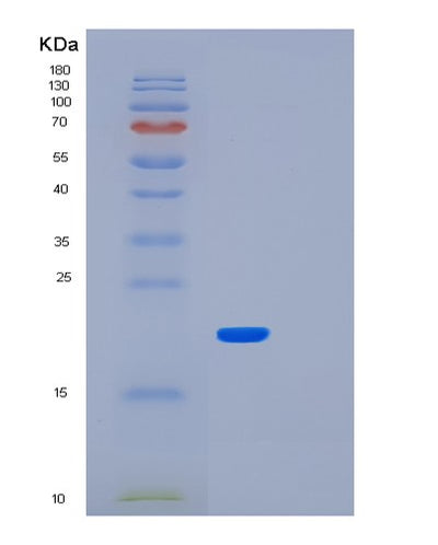 SDS-PAGE analysis of Human LMO1 (Rhombotin-1) - Recombinant Protein, CAT# BLT-01731P, showing >95% purity under 15% SDS-PAGE (Reduced)Human LMO1 (Rhombotin-1) - Recombinant Protein