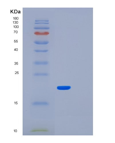 SDS-PAGE analysis of Human LMO1 (Rhombotin-1) - Recombinant Protein, CATHuman LMO1 (Rhombotin-1) - Recombinant Protein