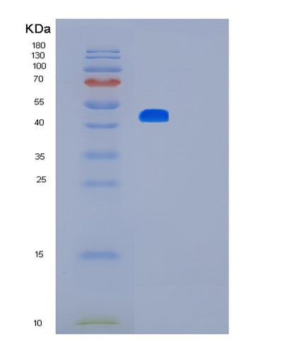 SDS-PAGE analysis of Human LMX1B (Lim Homeobox Transcription Factor 1-Beta) - Recombinant Protein, CAT# BLT-01732P, showing >90% purity under 15% SDS-PAGE (Reduced)Human LMX1B (Lim Homeobox Transcription Factor 1-Beta) - Recombinant Protein