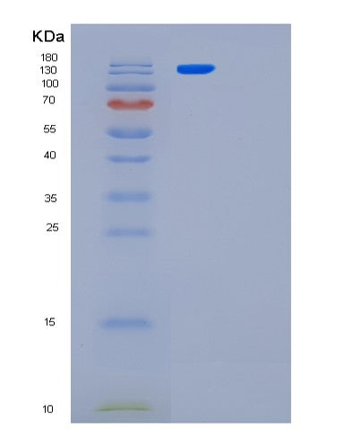 SDS-PAGE analysis of Human LRRC59 (Leucine-Rich Repeat-Containing Protein 59) - Recombinant Protein, CATHuman LRRC59 (Leucine-Rich Repeat-Containing Protein 59) - Recombinant Protein