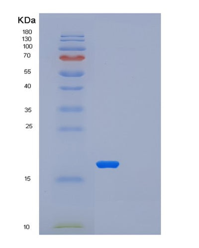 SDS-PAGE analysis of Human LSM1 (U6 Snrna-Associated Sm-Like Protein Lsm1) - Recombinant Protein, CAT# BLT-01741P, showing >90% purity under 15% SDS-PAGE (Reduced)Human LSM1 (U6 Snrna-Associated Sm-Like Protein Lsm1) - Recombinant Protein