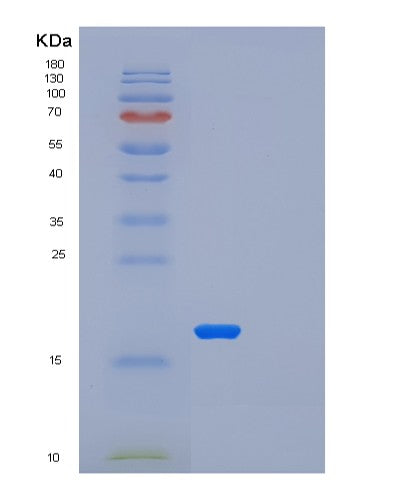 SDS-PAGE analysis of Human LSM1 (U6 Snrna-Associated Sm-Like Protein Lsm1) - Recombinant Protein, CATHuman LSM1 (U6 Snrna-Associated Sm-Like Protein Lsm1) - Recombinant Protein