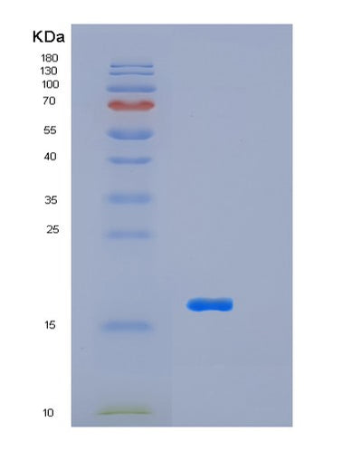 SDS-PAGE analysis of Human LSM4 (U6 Snrna-Associated Sm-Like Protein Lsm4) - Recombinant Protein, CAT# BLT-01744P, showing >90% purity under 15% SDS-PAGE (Reduced)Human LSM4 (U6 Snrna-Associated Sm-Like Protein Lsm4) - Recombinant Protein