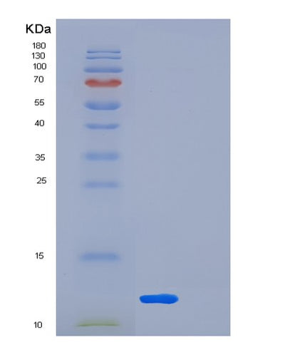 SDS-PAGE analysis of Human LSM5 (U6 Snrna-Associated Sm-Like Protein Lsm5) - Recombinant Protein, CAT# BLT-01745P, showing >85% purity under 15% SDS-PAGE (Reduced)Human LSM5 (U6 Snrna-Associated Sm-Like Protein Lsm5) - Recombinant Protein