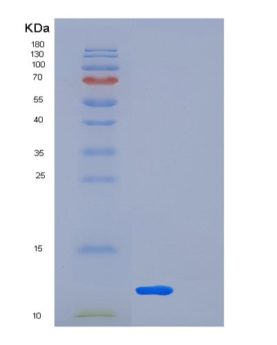 SDS-PAGE analysis of Human LSM5 (U6 Snrna-Associated Sm-Like Protein Lsm5) - Recombinant Protein, CATHuman LSM5 (U6 Snrna-Associated Sm-Like Protein Lsm5) - Recombinant Protein
