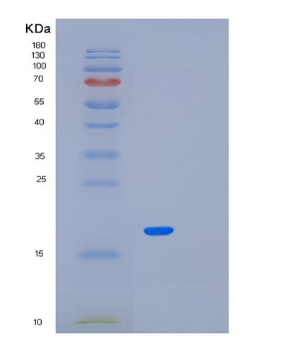 SDS-PAGE analysis of Human MED21 (Mediator Of Rna Polymerase Ii Transcription Subunit 21) - Recombinant Protein, CAT# BLT-01824P, showing >95% purity under 15% SDS-PAGE (Reduced)Human MED21 (Mediator Of Rna Polymerase Ii Transcription Subunit 21) - Recombinant Protein