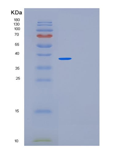 SDS-PAGE analysis of Human MED27 (Mediator Of Rna Polymerase Ii Transcription Subunit 27) - Recombinant Protein, CAT# BLT-01825P, showing >90% purity under 15% SDS-PAGE (Reduced)Human MED27 (Mediator Of Rna Polymerase Ii Transcription Subunit 27) - Recombinant Protein