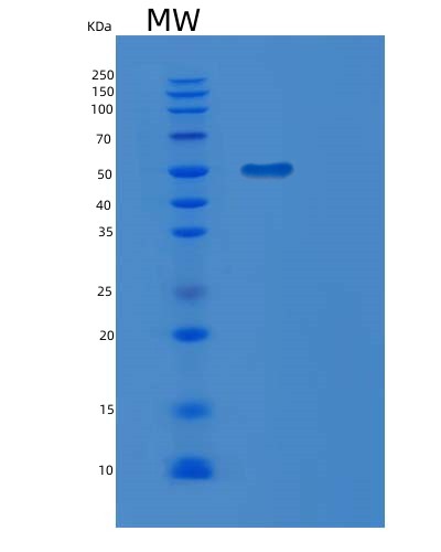 SDS-PAGE analysis of Human MGAT2 (Alpha-1,6-Mannosyl-Glycoprotein 2-Beta-N-Acetylglucosaminyltransferase) - Recombinant Protein, CATHuman MGAT2 (Alpha-1,6-Mannosyl-Glycoprotein 2-Beta-N-Acetylglucosaminyltransferase) - Recombinant Protein