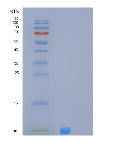 SDS-PAGE analysis of Human MLANA (Melanoma Antigen Recognized By T-Cells 1) - Recombinant Protein, CAT# BLT-01863P, showing >95% purity under 15% SDS-PAGE (Reduced)Human MLANA (Melanoma Antigen Recognized By T-Cells 1) - Recombinant Protein
