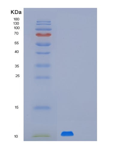 SDS-PAGE analysis of Human MUSTN1 (Musculoskeletal Embryonic Nuclear Protein 1) - Recombinant Protein, CAT# BLT-01925P, showing >90% purity under 15% SDS-PAGE (Reduced)Human MUSTN1 (Musculoskeletal Embryonic Nuclear Protein 1) - Recombinant Protein