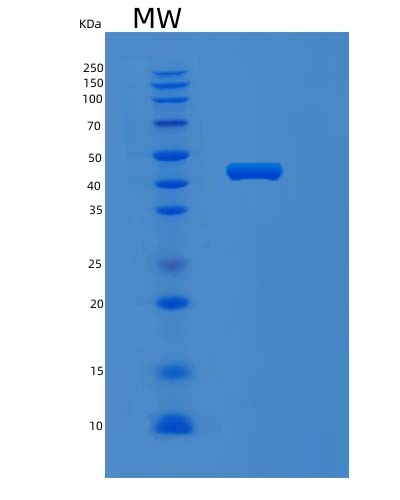 SDS-PAGE analysis of Human MVK (Mevalonate Kinase) - Recombinant Protein, CAT# BLT-01928P, showing >95% purity under 15% SDS-PAGE (Reduced)Human MVK (Mevalonate Kinase) - Recombinant Protein