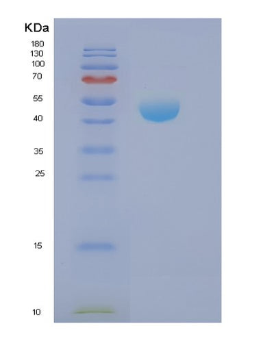 SDS-PAGE analysis of Human NCK2 (Cytoplasmic Protein Nck2) - Recombinant Protein, CAT# BLT-01980P, showing >85% purity under 15% SDS-PAGE (Reduced)Human NCK2 (Cytoplasmic Protein Nck2) - Recombinant Protein