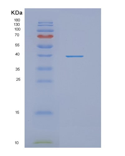 SDS-PAGE analysis of Human NDRG1 (Protein Ndrg1) - Recombinant Protein, CATHuman NDRG1 (Protein Ndrg1) - Recombinant Protein