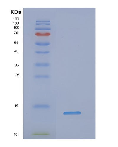 SDS-PAGE analysis of Human NDUFA2 (Nadh Dehydrogenase [Ubiquinone] 1 Alpha Subcomplex Subunit 2) - Recombinant Protein, CAT# BLT-01993P, showing >90% purity under 15% SDS-PAGE (Reduced)Human NDUFA2 (Nadh Dehydrogenase [Ubiquinone] 1 Alpha Subcomplex Subunit 2) - Recombinant Protein