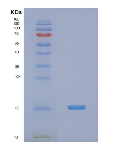 SDS-PAGE analysis of Human NDUFA5 (Nadh Dehydrogenase [Ubiquinone] 1 Alpha Subcomplex Subunit 5) - Recombinant Protein, CAT# BLT-01995P, showing >95% purity under 15% SDS-PAGE (Reduced)Human NDUFA5 (Nadh Dehydrogenase [Ubiquinone] 1 Alpha Subcomplex Subunit 5) - Recombinant Protein