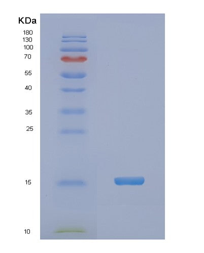 SDS-PAGE analysis of Human NDUFA5 (Nadh Dehydrogenase [Ubiquinone] 1 Alpha Subcomplex Subunit 5) - Recombinant Protein, CATHuman NDUFA5 (Nadh Dehydrogenase [Ubiquinone] 1 Alpha Subcomplex Subunit 5) - Recombinant Protein