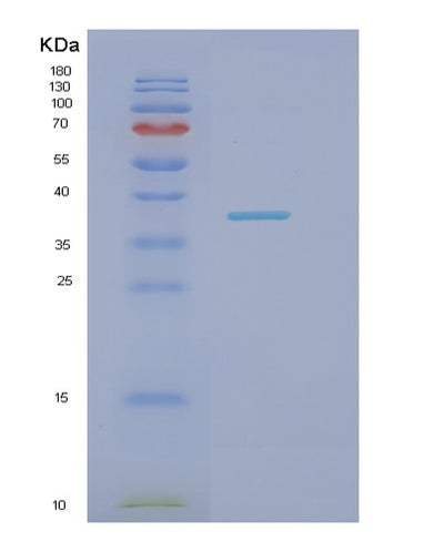 SDS-PAGE analysis of Human NECTIN1 (Nectin-1) - Recombinant Protein, CAT# BLT-02008P, showing >90% purity under 15% SDS-PAGE (Reduced)Human NECTIN1 (Nectin-1) - Recombinant Protein