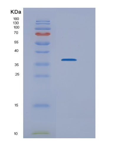 SDS-PAGE analysis of Human NEK7 (Serine/Threonine-Protein Kinase Nek7) - Recombinant Protein, CAT# BLT-02012P, showing >85% purity under 15% SDS-PAGE (Reduced)Human NEK7 (Serine/Threonine-Protein Kinase Nek7) - Recombinant Protein