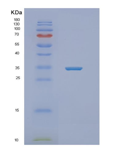 SDS-PAGE analysis of Human NEURL2 (Neuralized-Like Protein 2) - Recombinant Protein, CAT# BLT-02015P, showing >85% purity under 15% SDS-PAGE (Reduced)Human NEURL2 (Neuralized-Like Protein 2) - Recombinant Protein
