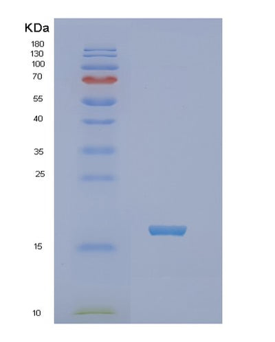 SDS-PAGE analysis of Human NHLH2 (Helix-Loop-Helix Protein 2) - Recombinant Protein, CAT# BLT-02025P, showing >90% purity under 15% SDS-PAGE (Reduced)Human NHLH2 (Helix-Loop-Helix Protein 2) - Recombinant Protein