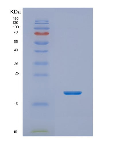 SDS-PAGE analysis of Human NHP2 (H/Aca Ribonucleoprotein Complex Subunit 2) - Recombinant Protein, CAT# BLT-02026P, showing >85% purity under 15% SDS-PAGE (Reduced)Human NHP2 (H/Aca Ribonucleoprotein Complex Subunit 2) - Recombinant Protein