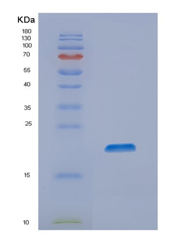 SDS-PAGE analysis of Human NIP7 (60S Ribosome Subunit Biogenesis Protein Nip7 Homolog) - Recombinant Protein, CAT# BLT-02028P, showing >90% purity under 15% SDS-PAGE (Reduced)Human NIP7 (60S Ribosome Subunit Biogenesis Protein Nip7 Homolog) - Recombinant Protein