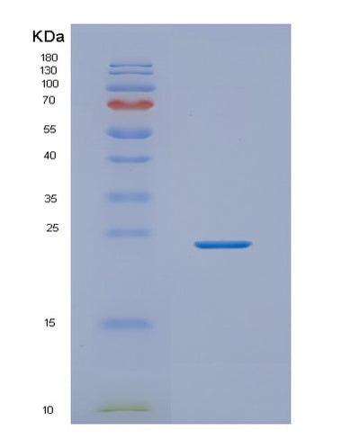 SDS-PAGE analysis of Human NKIRAS2 (Nf-Kappa-B Inhibitor-Interacting Ras-Like Protein 2) - Recombinant Protein, CAT# BLT-02032P, showing >85% purity under 15% SDS-PAGE (Reduced)Human NKIRAS2 (Nf-Kappa-B Inhibitor-Interacting Ras-Like Protein 2) - Recombinant Protein